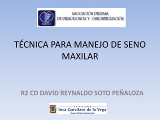 TÉCNICA PARA MANEJO DE SENO
MAXILAR
R2 CD DAVID REYNALDO SOTO PEÑALOZA
 