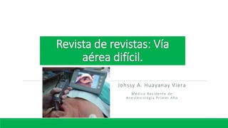 Johssy A. Huayanay Viera
Médico Residente de
Anestesiología Primer Año
 