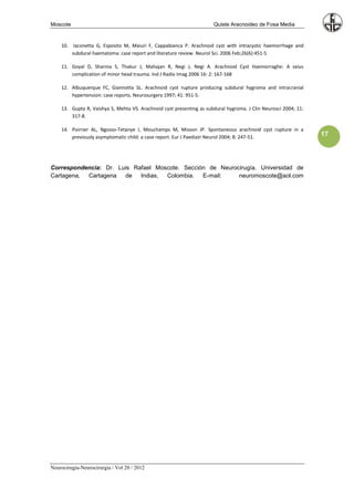 Moscote                                                               Quiste Aracnoideo de Fosa Media


    10. Iaconetta G, Esposito M, Maiuri F, Cappabianca P. Arachnoid cyst with intracystic haemorrhage and
        subdural haematoma: case report and literature review. Neurol Sci. 2006 Feb;26(6):451-5

    11. Goyal D, Sharma S, Thakur J, Mahajan R, Negi J, Negi A. Arachnoid Cyst Haemorraghe: A seius
        complication of minor head trauma. Ind J Radio Imag 2006 16: 2: 167-168

    12. Albuquerque FC, Giannotta SL. Arachnoid cyst rupture producing subdural hygroma and intracranial
        hypertension: case reports. Neurosurgery 1997; 41: 951-5.

    13. Gupta R, Vaishya S, Mehta VS. Arachnoid cyst presenting as subdural hygroma. J Clin Neurosci 2004; 11:
        317-8.

    14. Poirrier AL, Ngosso-Tetanye I, Mouchamps M, Misson JP. Spontaneous arachnoid cyst rupture in a
        previously asymptomatic child: a case report. Eur J Paediatr Neurol 2004; 8: 247-51.                     17




Correspondencia: Dr. Luis Rafael Moscote. Sección de Neurocirugía. Universidad de
Cartagena, Cartagena   de Indias, Colombia. E-mail:        neuromoscote@aol.com




Neurocirugía-Neurocirurgia / Vol 20 / 2012
 