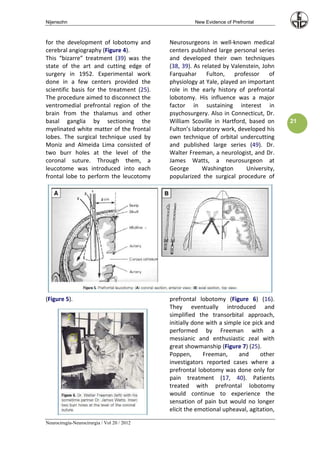 Nijensohn                                             New Evidence of Prefrontal



for the development of lobotomy and          Neurosurgeons in well-known medical
cerebral angiography (Figure 4).             centers published large personal series
This “bizarre” treatment (39) was the        and developed their own techniques
state of the art and cutting edge of         (38, 39). As related by Valenstein, John
surgery in 1952. Experimental work           Farquahar      Fulton,   professor    of
done in a few centers provided the           physiology at Yale, played an important
scientific basis for the treatment (25).     role in the early history of prefrontal
The procedure aimed to disconnect the        lobotomy. His influence was a major
ventromedial prefrontal region of the        factor in sustaining interest in
brain from the thalamus and other            psychosurgery. Also in Connecticut, Dr.
basal ganglia by sectioning the              William Scoville in Hartford, based on      21
myelinated white matter of the frontal       Fulton’s laboratory work, developed his
lobes. The surgical technique used by        own technique of orbital undercutting
Moniz and Almeida Lima consisted of          and published large series (49). Dr.
two burr holes at the level of the           Walter Freeman, a neurologist, and Dr.
coronal suture. Through them, a              James Watts, a neurosurgeon at
leucotome was introduced into each           George       Washington      University,
frontal lobe to perform the leucotomy        popularized the surgical procedure of




(Figure 5).                                  prefrontal lobotomy (Figure 6) (16).
                                             They eventually introduced and
                                             simplified the transorbital approach,
                                             initially done with a simple ice pick and
                                             performed by Freeman with a
                                             messianic and enthusiastic zeal with
                                             great showmanship (Figure 7) (25).
                                             Poppen,       Freeman,     and      other
                                             investigators reported cases where a
                                             prefrontal lobotomy was done only for
                                             pain treatment (17, 40). Patients
                                             treated with prefrontal lobotomy
                                             would continue to experience the
                                             sensation of pain but would no longer
                                             elicit the emotional upheaval, agitation,

Neurocirugía-Neurocirurgia / Vol 20 / 2012
 