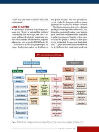 Volume 02 | No
02 | agosto/2013 13
rações oculares poderão ocorrer nos casos
mais graves14
.
CAUSAS DE OLHO SECO
A classificação etiológica de olho seco pro-
posta pelo “Report of National Eye Institute/
Industry Dry Eye Workshop”, em 199515
, ex-
posta na Figura 4, ainda é a mais aceita, em-
bora tenha sofrido, posteriormente, algumas
adaptações pelo grupo do DEWS (Figura 5).
Com relação à classificação etiológica, as
causas de olho seco podem ser divididas em
dois grupos maiores: olho seco por deficiên-
cia na produção do componente aquoso e
por excessiva evaporação do filme lacrimal.
No olho seco aquoso-deficiente, a falta de
produção lacrimal poderá ocorrer tanto pela
destruição ou disfunção acinar como também
pelas alterações neurossensoriais do estímu-
lo ao lacrimejamento. Também podem estar
incluídas no grupo as condições nas quais
ocorre obstrução à drenagem do fluido lacri-
mal14
. O grupo de olho seco aquoso-deficiente
foi dividido em dois subgrupos: síndrome
Figura 4. Classificação etiológica do olho seco: Report of National Eye Institute/Industry Dry EyeWorkshop, 1995.
Olho seco ou ceratoconjuntivite sicca
Deficiência de lágrima Evaporativo
S.de Sjögren Não Sjögren
Primária
Secundária
Artrite reumatóide
Lupus e.sistêmico
G.deWegener
Esclerose sistêmica
Cirrose biliar primária
Poliarterite nodosa
Doença mista do
tecido conectivo
Outras
Doença lacrimal
Primária
Alacrima
congênita
Doença primária
da glândula
lacrimal
Secundária
Sarcoidose
Xeroftalmia,
HIV,GVHD
Tracoma
Queimadura
alcalina
Eritema
multiforme
Penfigóide
cicatricial
Obstrução da
secreção lacrimal Reflexa
Infecção
Cirurgia
Medicações
Diabetes mellitus
Envelhecimento
Ceratopatia
neuroparalítica
Lesão do nervo
trigêmeo
Deficiência
de lípides
Ausência de
glândulas
Distiquiase
Blefarite posterior
Disfunção de
G.de Meibomius
Blefarite anterior
Alterações
do piscar
Alterações da
fenda palpebral
Alteração da
superfície
Xeroftalmia
Relacionada
a pálpebra
Lentes de contato
Incongruências
da pálpebra
 