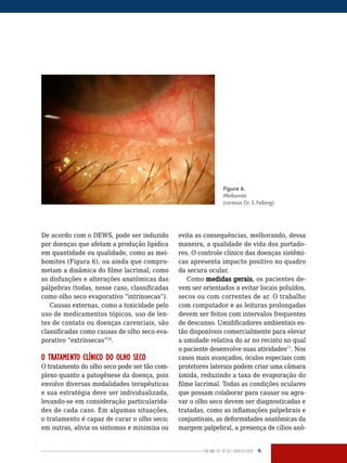 Volume 02 | No
02 | agosto/2013 15
De acordo com o DEWS, pode ser induzido
por doenças que afetam a produção lipídica
em quantidade ou qualidade, como as mei-
bomites (Figura 6), ou ainda que compro-
metam a dinâmica do filme lacrimal, como
as disfunções e alterações anatômicas das
pálpebras (todas, nesse caso, classificadas
como olho seco evaporativo “intrínsecas”).
Causas externas, como a toxicidade pelo
uso de medicamentos tópicos, uso de len-
tes de contato ou doenças carenciais, são
classificadas como causas de olho seco eva-
porativo “extrínsecas”14
.
O TRATAMENTO CLÍNICO DO OLHO SECO
O tratamento do olho seco pode ser tão com-
plexo quanto a patogênese da doença, pois
envolve diversas modalidades terapêuticas
e sua estratégia deve ser individualizada,
levando-se em consideração particularida-
des de cada caso. Em algumas situações,
o tratamento é capaz de curar o olho seco;
em outras, alivia os sintomas e minimiza ou
evita as consequências, melhorando, dessa
maneira, a qualidade de vida dos portado-
res. O controle clínico das doenças sistêmi-
cas apresenta impacto positivo no quadro
da secura ocular.
Como medidas gerais, os pacientes de-
vem ser orientados a evitar locais poluídos,
secos ou com correntes de ar. O trabalho
com computador e as leituras prolongadas
devem ser feitos com intervalos frequentes
de descanso. Umidificadores ambientais es-
tão disponíveis comercialmente para elevar
a umidade relativa do ar no recinto no qual
o paciente desenvolve suas atividades17
. Nos
casos mais avançados, óculos especiais com
protetores laterais podem criar uma câmara
úmida, reduzindo a taxa de evaporação do
filme lacrimal. Todas as condições oculares
que possam colaborar para causar ou agra-
var o olho seco devem ser diagnosticadas e
tratadas, como as inflamações palpebrais e
conjuntivais, as deformidades anatômicas da
margem palpebral, a presença de cílios anô-
Figura 6.
Meibomite
(cortesia Dr. S. Felberg).
 