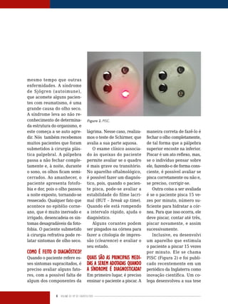 6 Volume 02 | No
02 | agosto/2013
mesmo tempo que outras
enfermidades. A síndrome
de Sjögren (autoimune),
que acomete alguns pacien-
tes com reumatismo, é uma
grande causa do olho seco.
A síndrome leva ao não re-
conhecimento de determina-
da estrutura do organismo, e
este começa a se auto agre-
dir. Nós também recebemos
muitos pacientes que foram
submetidos à cirurgia plás-
tica palpebral. A pálpebra
passa a não fechar comple-
tamente e, à noite, durante
o sono, os olhos ficam semi-
cerrados. Ao amanhecer, o
paciente apresenta fotofo-
bia e dor, pois o olho passou
a noite exposto, tornando-se
ressecado. Qualquer fato que
acontece no epitélio corne-
ano, que é muito inervado e
irrigado, desencadeia os sin-
tomas desagradáveis da foto-
fobia. O paciente submetido
à cirurgia refrativa pode re-
latar sintomas de olho seco.
COMO É FEITO O DIAGNÓSTICO?
Quando o paciente refere es-
ses sintomas supracitados, é
preciso avaliar alguns fato-
res, com a possível falta de
algum dos componentes da
lágrima. Nesse caso, realiza-
mos o teste de Schirmer, que
avalia a sua parte aquosa.
O exame clínico associa-
do às queixas do paciente
permite avaliar se o quadro
é mais grave ou transitório.
No aparelho oftalmológico,
é possível fazer um diagnós-
tico, pois, quando o pacien-
te pisca, pode-se avaliar a
estabilidade do filme lacri-
mal (BUT – break up time).
Quando ele está rompendo
a intervalo rápido, ajuda o
diagnóstico.
Alguns corantes podem
ser pingados na córnea para
fazer a citologia de impres-
são (clearence) e avaliar o
seu estado.
QUAIS SÃO AS PRINCIPAIS MEDI-
DAS A SEREM ADOTADAS QUANDO
A SÍNDROME É DIAGNOSTICADA?
Em primeiro lugar, é preciso
ensinar o paciente a piscar. A
maneira correta de fazê-lo é
fechar o olho completamente,
de tal forma que a pálpebra
superior encoste na inferior.
Piscar é um ato reflexo, mas,
se o indivíduo pensar sobre
ele, fazendo-o de forma cons-
ciente, é possível avaliar se
pisca corretamente ou não e,
se preciso, corrigir-se.
Outra coisa a ser avaliada
é se o paciente pisca 15 ve-
zes por minuto, número su-
ficiente para hidratar a cór-
nea. Para que isso ocorra, ele
deve piscar, contar até três,
piscar novamente, e assim
sucessivamente.
Inclusive, eu desenvolvi
um aparelho que estimula
o paciente a piscar 15 vezes
por minuto. Ele se chama
PISC (Figura 2) e foi publi-
cado recentemente em um
periódico da Inglaterra como
inovação científica. Um co-
lega desenvolveu a sua tese
Figura 2. PISC.
 