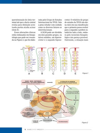 10 VOLUME 03 | NO
01 | MARÇO/2014
Figura 1
Figura 2
queratinização do óstio ter-
minal até que o ducto central
evolua para dilatação acen-
tuada porém atrofia acinar
(item E).
Essas alterações clínicas
estão embasadas em fisiopa-
tologia que pode ser resumi-
da na Figura 2, que foi elabo-
rada pelo Grupo de Estudos
Internacional da TFOS. Vale
a pena estudar com cuidado
como os diversos fatores se
interrelacionam.
A DGM pode ser dividida
em dois grandes grupos, ou
talvez estádios, um hiperse-
cretor e o segundo hipose-
cretor. O relatório do grupo
de estudos da TFOS não dei-
xa claro em sua classificação
que o primeiro possa evoluir
para o segundo e prefere es-
tadiá-los lado a lado, embo-
ra pelo raciocínio fisiopato-
lógico isto pareça provável.
Outrossim, a situação mais
 