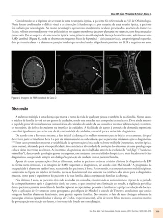 Silva AMF, Costa FP, Baptista M, Febra T, Morna C. 
Considerando-se a hipótese de se tratar de uma neuropatia óptica, a paciente foi referenciada ao SU de Oftalmologia. 
Neste foram confirmados o déficit visual e as alterações à fundoscopia e, por suspeita de uma neurite óptica, a paciente 
foi avaliada por neurologista. Ao exame neurológico apresentava movimentos oculares preservados, ausência de dismetrias 
faciais, reflexos osteotendinosos vivos policinéticos nos quatro membros e cutâneo-plantares em extensão, com força muscular 
preservada. Por se suspeitar de uma neurite óptica como primeira manifestação de doença desmielinizante, solicitou-se uma 
RMN cerebral (Figura 4), onde se observaram pequenos focos de hipersinal – dois justacorticais, um peritrigonal esquerdo, 
dois periventriculares – e efetuou-se punção lombar que revelou bandas oligoclonais positivas no LCR e negativas no soro. 
Rev Bras Med Fam Comunidade. Rio de Janeiro, 2014 Out-Dec; 9(33):365-370. 369 
Figura 4. Imagens de RMN cerebral do Caso 2. 
Discussão 
A esclerose múltipla é uma doença que marca o rumo da vida de qualquer pessoa e também de sua família. Nestes casos, 
o médico de família deverá ser um gestor de cuidados, sendo esta uma das suas competências nucleares. Deve ainda assumir 
o papel de gestor de meios/recursos comunitários, de cuidados de saúde (da sua consulta e eventual referenciação) e também, 
se necessário, de defesa do paciente na interface de cuidados. A facilidade de acesso à consulta de demanda espontânea 
contribui igualmente para criar um elo de continuidade de cuidados, essencial para o raciocínio diagnóstico. 
De acordo com a literatura recente, a fase inicial da doença é o melhor momento para se iniciar o tratamento, do qual 
deve fazer parte o Interferon beta 1-a por via intramuscular ou subcutânea, que as pacientes iniciaram após o diagnóstico. 
8-11 Esses casos pretendem mostrar a variabilidade de apresentações clínicas da esclerose múltipla (parestesias, neurite óptica, 
entre outras), alertando para a inespecificidade, intermitência e diversidade de evolução dos sintomas de uma patologia que 
coloca várias incertezas ao clínico. As incertezas diagnósticas são trabalhadas através da exclusão de “red flags” (“bandeiras 
vermelhas”), descartando patologias graves ou urgentes, em conjunto com os cuidados hospitalares, mais focados em fechar 
diagnósticos, assegurando sempre um diálogo/negociação do cuidado com o paciente/família. 
Apesar de terem apresentações clínicas diferentes, ambas as pacientes reúnem critérios clínicos de diagnóstico de EM 
na forma surto-remissão, e as imagens de RMN suportam o diagnóstico, de acordo com McDonald.3 A progressão da 
incapacidade é altamente variável mas, na maioria dos pacientes, é lenta. Assim sendo, o acompanhamento multidisciplinar, 
sustentado na figura do médico de família, torna-se fundamental não somente na evidência dos sinais para o diagnóstico 
precoce, como para o seguimento do paciente e de sua família, dada a repercussão familiar da doença. 
Nos últimos 3 anos, as pacientes têm sido avaliadas em consulta, encontrando-se assintomáticas. Apesar de o período 
de acompanhamento após o diagnóstico ainda ser curto, o que constitui uma limitação ao estudo, a vigilância periódica 
dessas pacientes permite ao médico de família explorar as expectativas pessoais e familiares e a própria evolução da doença. 
Após a aplicação de ferramentas como genograma, psicofigura de Mitchell e círculo de Thrower, concluímos que ambas 
integram famílias altamente funcionais, com grande suporte familiar. No entanto, o fato de seus cônjuges sofrerem de 
patologias crônicas (paramiloidose e doença de Crohn, respectivamente), além de terem filhos menores, constitui motivo 
de preocupação em relação ao futuro, e isso tem sido levado em consideração. 
 