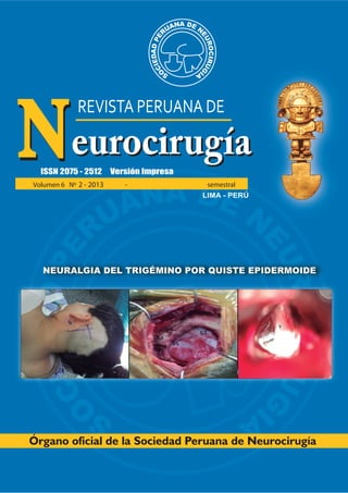 LIMA - PERÚ
NEURALGIA DEL TRIGÉMINO POR QUISTE EPIDERMOIDE
2 - 2013 semestral
 