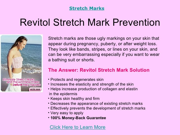 revitol stretch mark