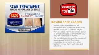  Revitol Scar Cream removes the
appearance of Acne Scars, Burns, cuts,
gashes and scars caused by surgery.
 We’ve worked hard to develop a blend
of all-natural ingredients that fortify your
skin with proteins and vitamins.
 This formula helps combat the causes of
scarring and heal skin from scars
caused by acne, burns, and other
factors in a way that’s both safe and
effective.
Revitol Scar Cream
 