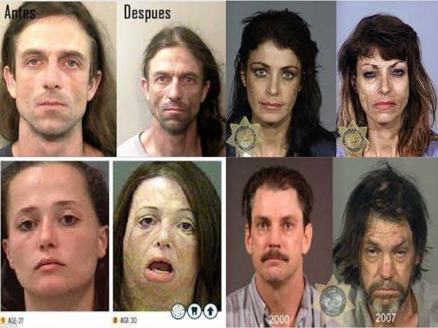 LAS DROGAS-V LAS DROGAS-V