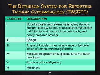 PSEDM 2019: Thyroid cancer among Filipinos | PPTX