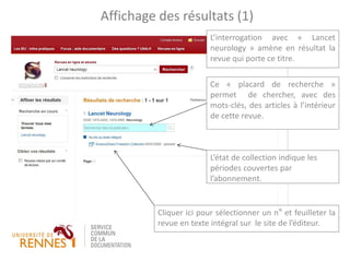 L’interrogation avec « Lancet
neurology » amène en résultat la
revue qui porte ce titre.
Affichage des résultats (1)
Ce « placard de recherche »
permet de chercher, avec des
mots-clés, des articles à l’intérieur
de cette revue.
Cliquer ici pour sélectionner un n° et feuilleter la
revue en texte intégral sur le site de l’éditeur.
L’état de collection indique les
périodes couvertes par
l’abonnement.
 