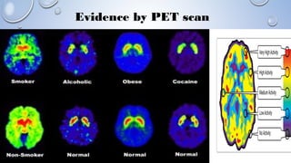 Evidence by PET scan
 