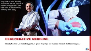 Already feasible: Lab made body parts, re-grown finger tips and muscles, skin cells that become eyes…
REGENERATIVE MEDICINE
Suzanne Somers, 64 years old in this
picture, brought age-extension
revolution to imagination of the
masses with her several books,
including the most popular “Ageless”
Way back in 1999, Anthony
Atala made the first bladder in
his lab, using patient’s own
stem cells. It is functioning
normally even today.
 