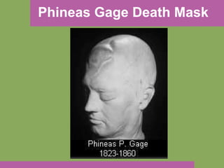 Phineas Gage Death Mask 