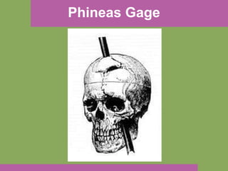 Phineas Gage 