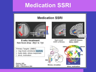 Medication SSRI 
