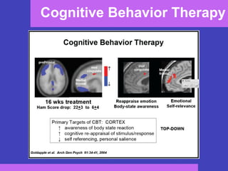 Cognitive Behavior Therapy 