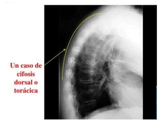 Osteología del Tórax