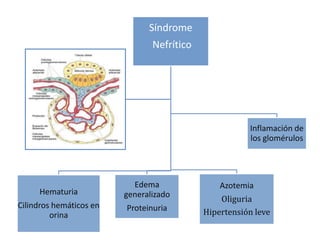 Síndrome
                                Nefrítico




                                                       Inflamación de
                                                       los glomérulos




                           Edema                Azotemia
     Hematuria           generalizado
                                                Oliguria
Cilindros hemáticos en   Proteinuria
         orina                              Hipertensión leve
 
