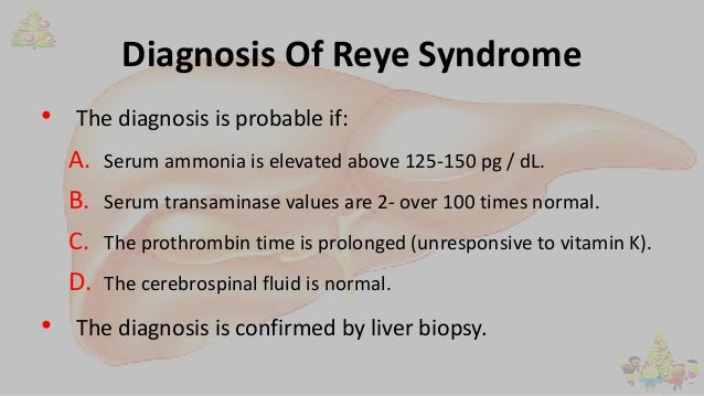 Reye Disease Definition - Astigmatism Glaucoma Swollen Eyes Disease