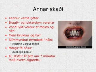 Annar skaði Tennur verða ljótar Bragð– og lyktarskyn versnar Vond lykt verður af fötum og hári  Fleiri hrukkur og fyrr Slímmyndun myndast í hálsi Hóstinn verður mikill Margir fá bólur  Aðallega konur Þú styttir líf þitt um 7 mínútur með hverri sígarettu 