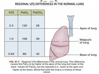REGIONAL V/Q DIFFERENCES IN THE NORMAL LUNG
 