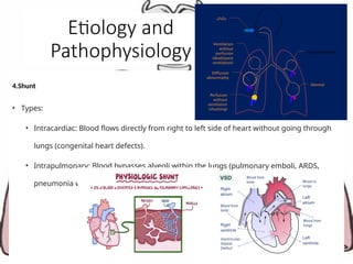 Etiology and
Pathophysiology
4.Shunt
• Types:
• Intracardiac: Blood flows directly from right to left side of heart without going through
lungs (congenital heart defects).
• Intrapulmonary: Blood bypasses alveoli within the lungs (pulmonary emboli, ARDS,
pneumonia with abscesses)
 