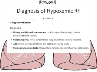 Diagnosis of Hypoxemic RF
• 1.Hypoventilation:
• Diagnosis:
• History and physical examination: Look for signs of respiratory distress,
decreased breath sounds.
• Chest X-ray: May reveal abnormalities like pneumonia or pleural effusions.
• ABG: Shows elevated CO2 levels and potentially low O2 levels.
• Pulmonary function tests: Measure lung function and identify airway obstruction.
 
