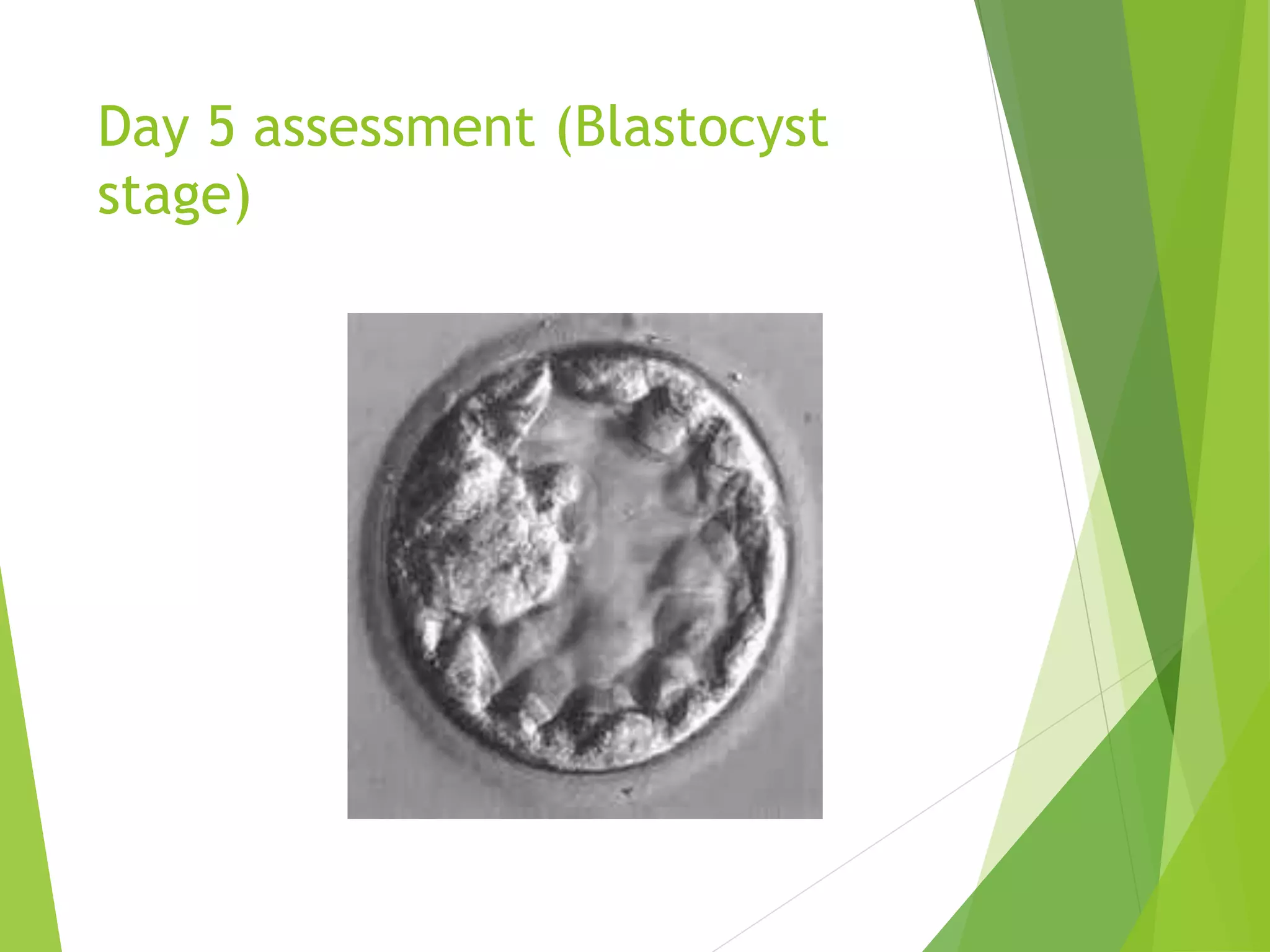 Day 5 assessment (Blastocyst
stage)
 