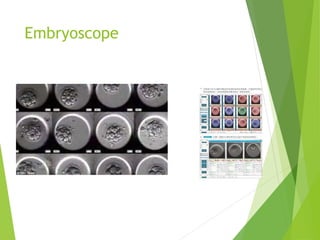 Embryoscope
 