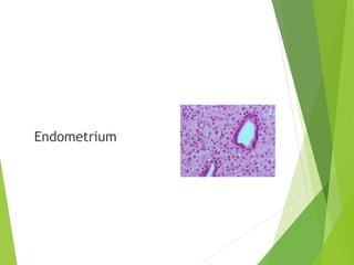 Endometrium
 