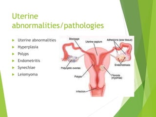 Uterine
abnormalities/pathologies
 Uterine abnormalities
 Hyperplasia
 Polyps
 Endometritis
 Synechiae
 Leiomyoma
 