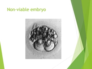 Non-viable embryo
 