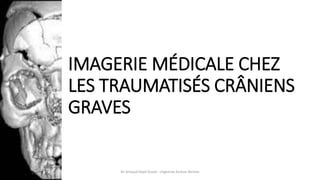 IMAGERIE MÉDICALE CHEZ
LES TRAUMATISÉS CRÂNIENS
GRAVES
Dr Arnaud Depil Duval - Urgences Evreux Vernon
 