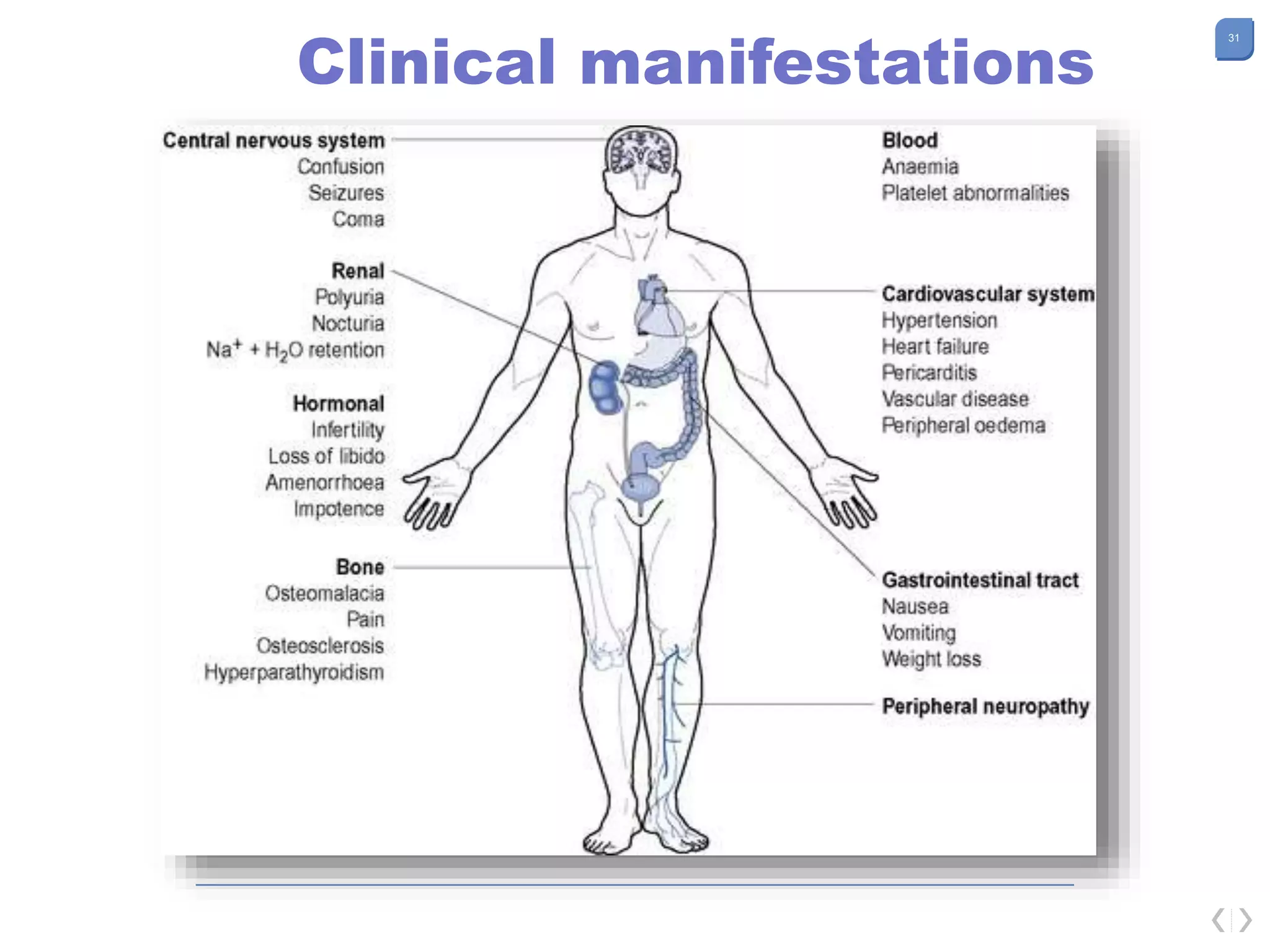 31
Clinical manifestations
 
