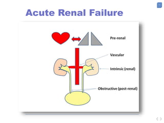 11
Acute Renal Failure
 