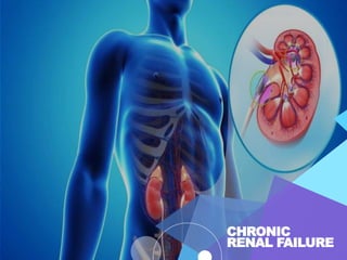 CHRONIC
RENAL FAILURE
 