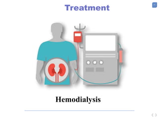 41
Treatment
Hemodialysis
 