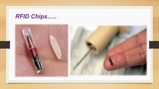 RFID Chips…..
 