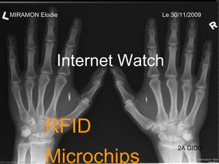 MIRAMON Elodie Le 30/11/2009 Internet Watch 2A GIDO RFID Microchips 