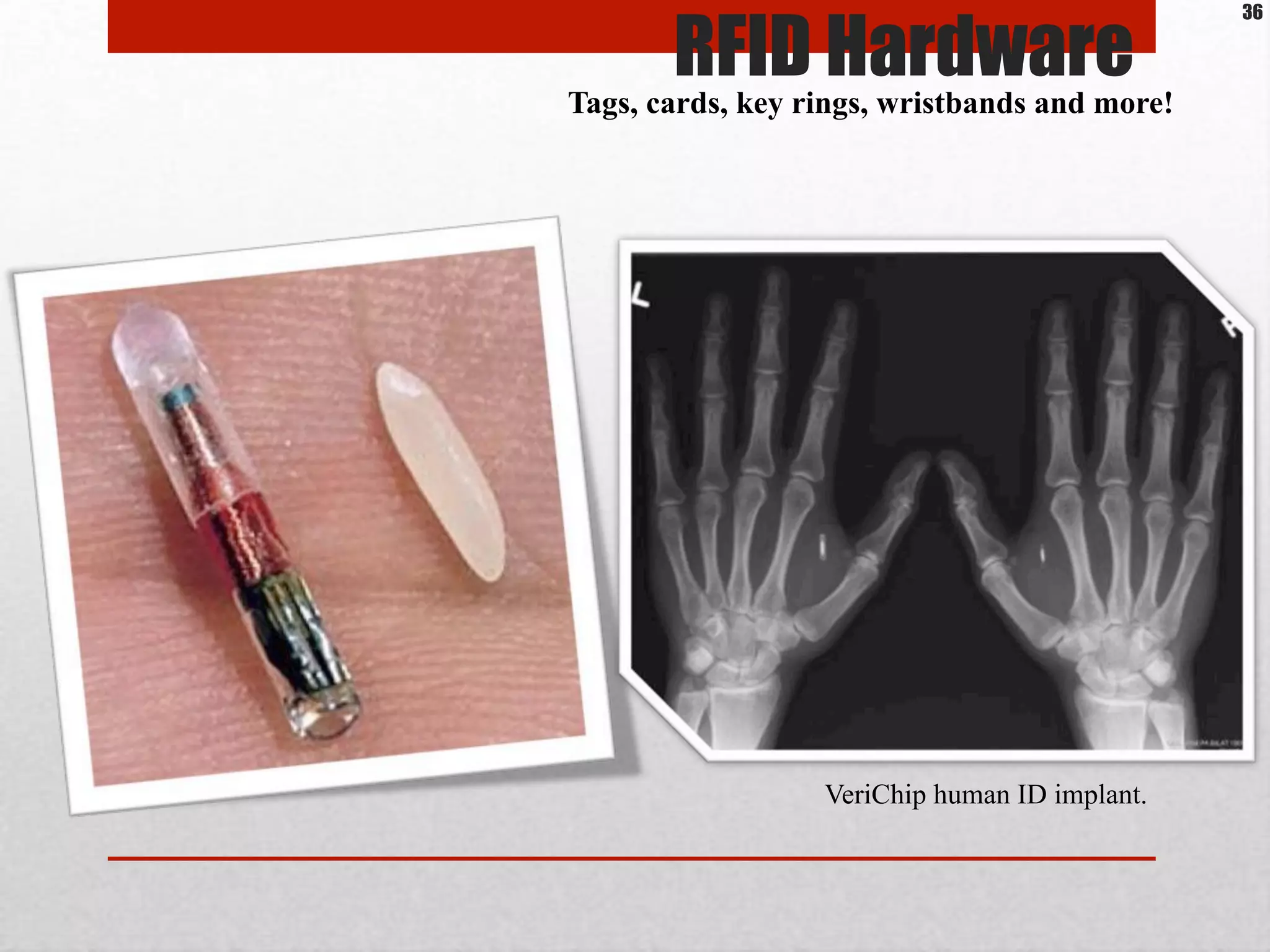 Tags, cards, key rings, wristbands and more!
VeriChip human ID implant.
RFID Hardware
36
 