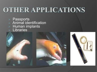 Passports
Animal identification
Human implants
Libraries