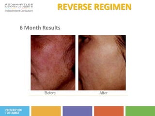 ANTI-AGE + AMP MD System~ How Do You Roll? ~ Use at least 3 nights per week after ANTI-AGE Daily Cleansing Maskand ANTI-AGE  Pore Minimizing Toner