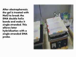 After electrophoresis,
the gel is treated with
NaCl to break the
DNA double helix
bonds and make it
single-stranded. This
allows later
hybridisation with a
single-stranded DNA
probe.
 