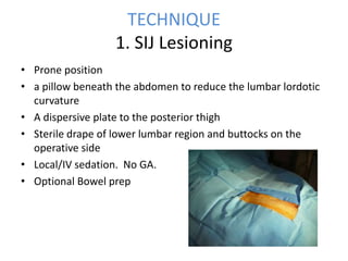 TECHNIQUE
1. SIJ Lesioning
• Prone position
• a pillow beneath the abdomen to reduce the lumbar lordotic
curvature
• A dispersive plate to the posterior thigh
• Sterile drape of lower lumbar region and buttocks on the
operative side
• Local/IV sedation. No GA.
• Optional Bowel prep
 