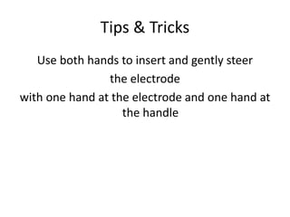 Tips & Tricks
Use both hands to insert and gently steer
the electrode
with one hand at the electrode and one hand at
the handle
 