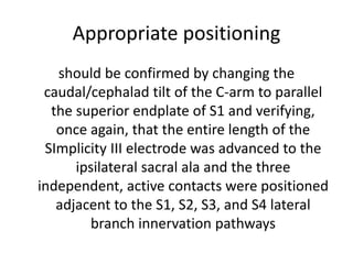 Appropriate positioning
should be confirmed by changing the
caudal/cephalad tilt of the C-arm to parallel
the superior endplate of S1 and verifying,
once again, that the entire length of the
SImplicity III electrode was advanced to the
ipsilateral sacral ala and the three
independent, active contacts were positioned
adjacent to the S1, S2, S3, and S4 lateral
branch innervation pathways
 