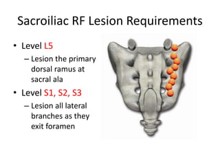 Sacroiliac RF Lesion Requirements
• Level L5
– Lesion the primary
dorsal ramus at
sacral ala
• Level S1, S2, S3
– Lesion all lateral
branches as they
exit foramen
 
