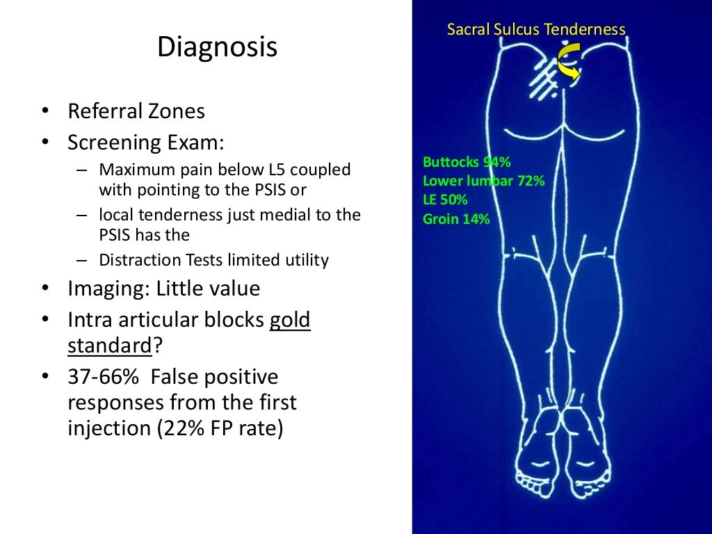 Sacroiliac Joint RF Denervation