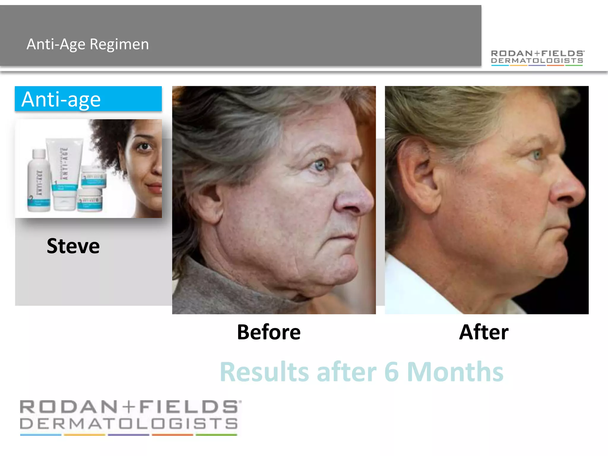 Anti-Age Regimen


Anti-age




  Steve


                    Before           After
                   Results after 6 Months
 